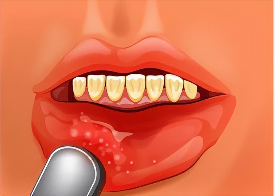 速效救心丸对急性心脏病有效么,速效救心丸对冠心病有效吗