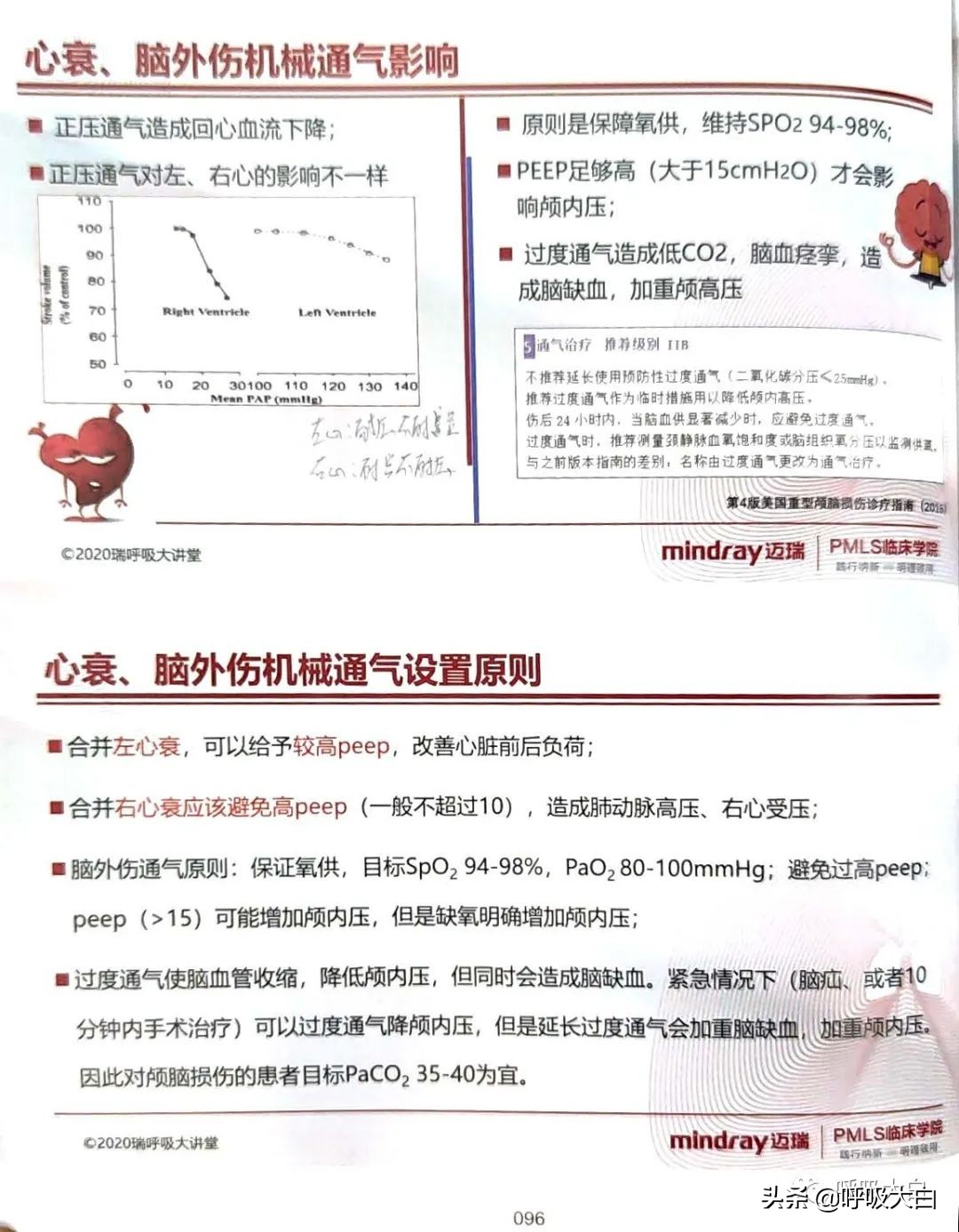呼吸机epr怎么调节,呼吸机如何调节温度