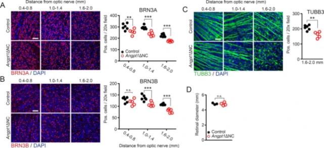 闭合性青光眼治疗突破,青光眼的修复之路