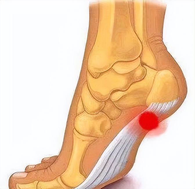 太马来了，跑友们要注意足踝部的运动损伤！