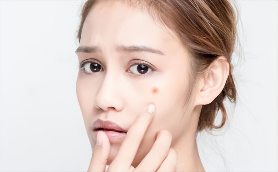 女人脸上有这三种征兆,脸上长斑是不是有妇科病的原因