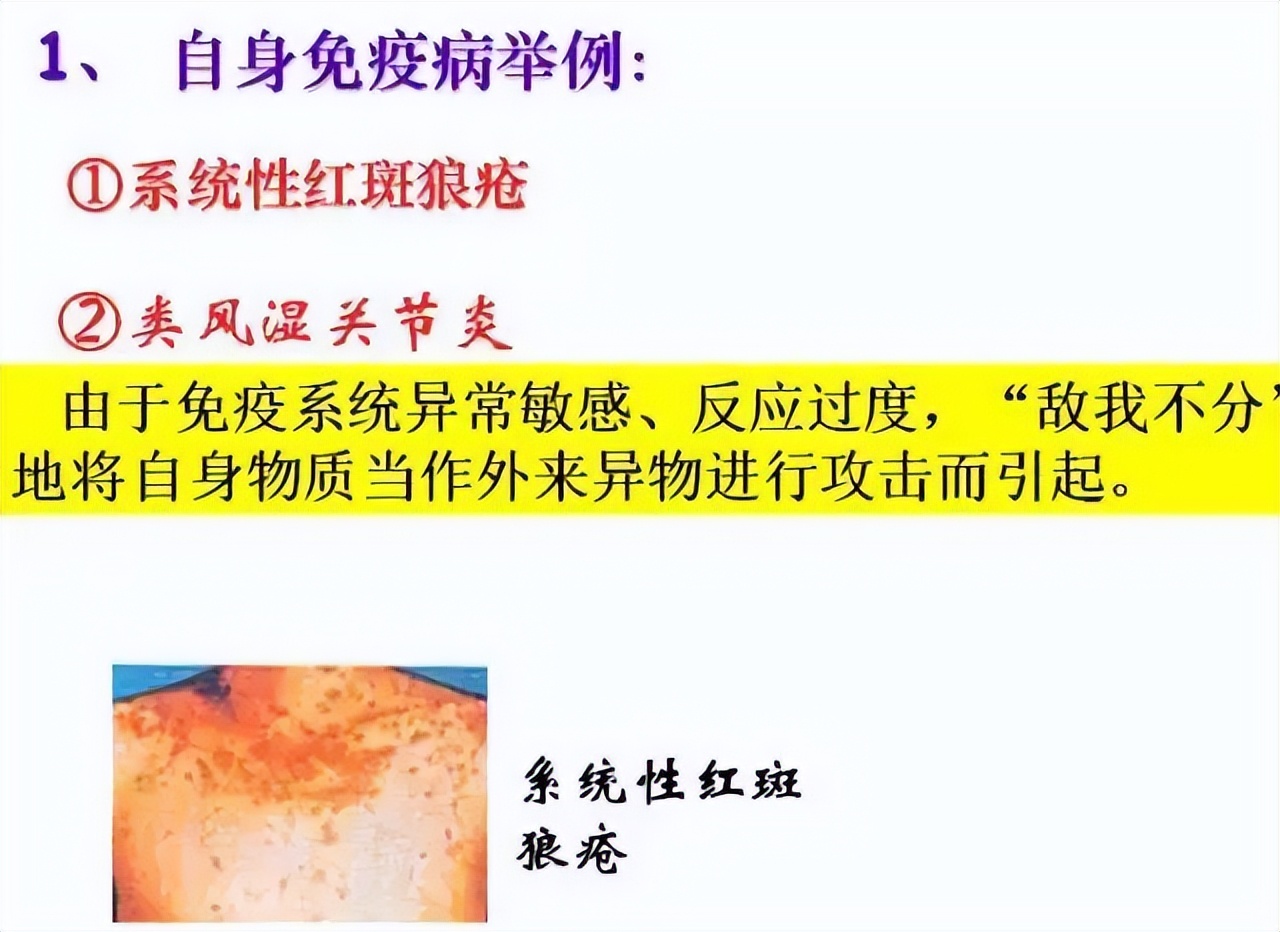 高中生物免疫失调知识点讲解视频,高中生物免疫调节