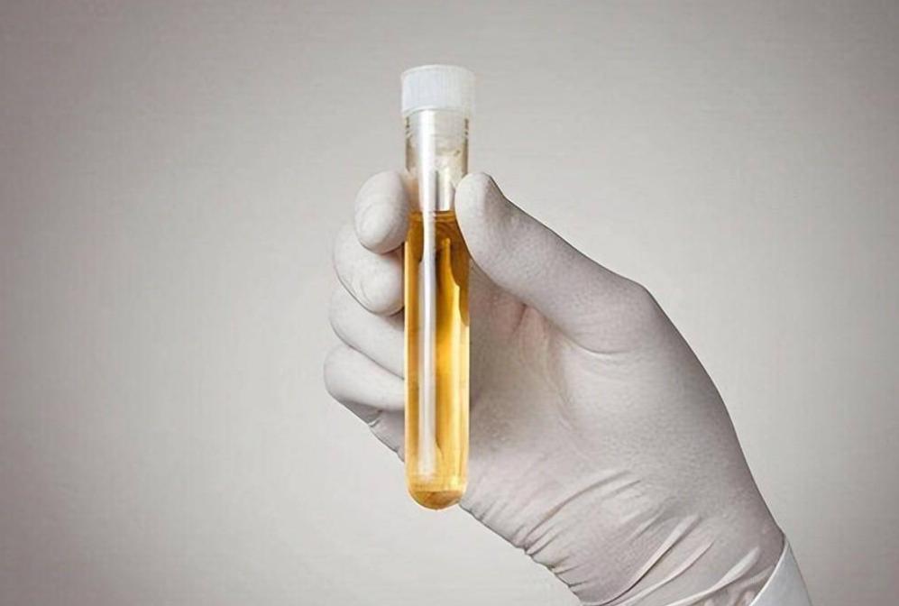 痰湿肥胖中医辨证论治,中医治疗痰湿肥胖的经方验方