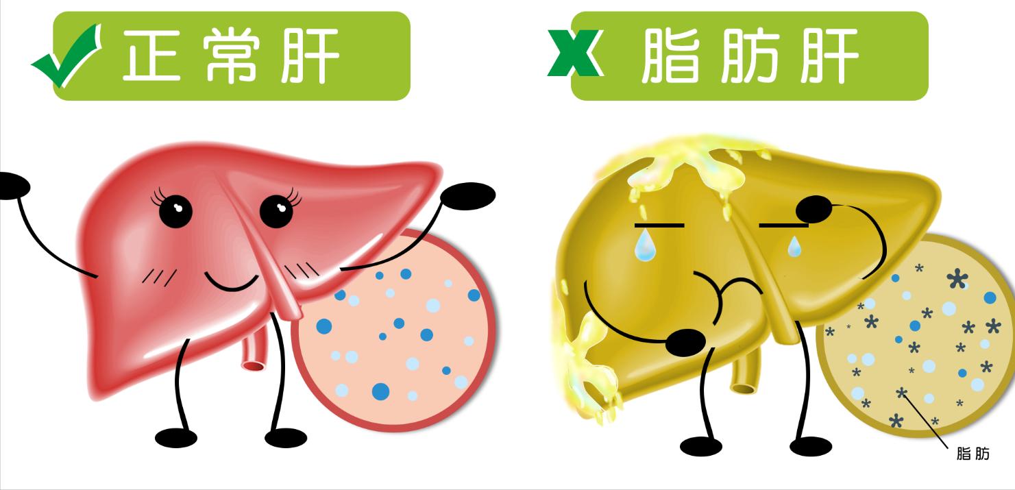 出汗多是脾虚还是肝虚,出汗多是脾虚还是肾虚怎么治疗