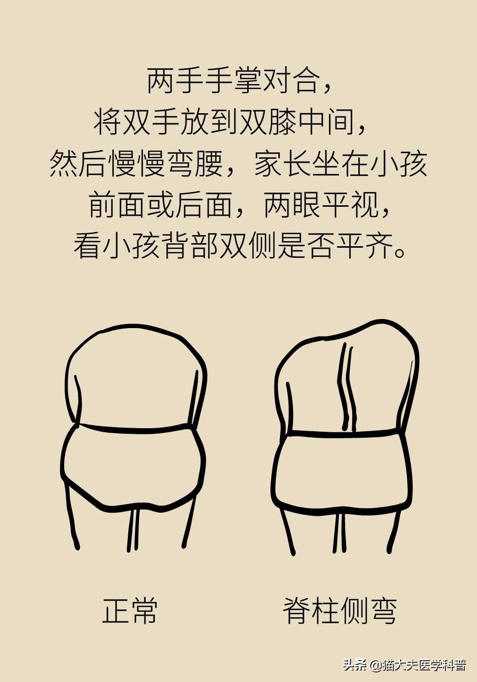 孩子老是驼着背走路感觉没自信,五十岁背有点驼怎么办