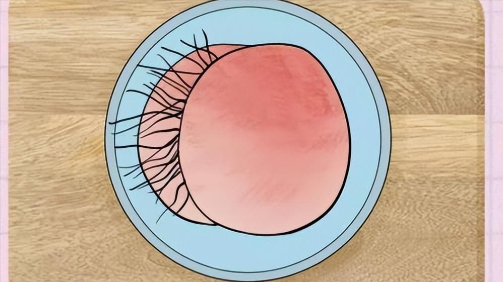 女性屁股上为啥也会长毛？能不能直接刮掉？为了健康，最好了解下