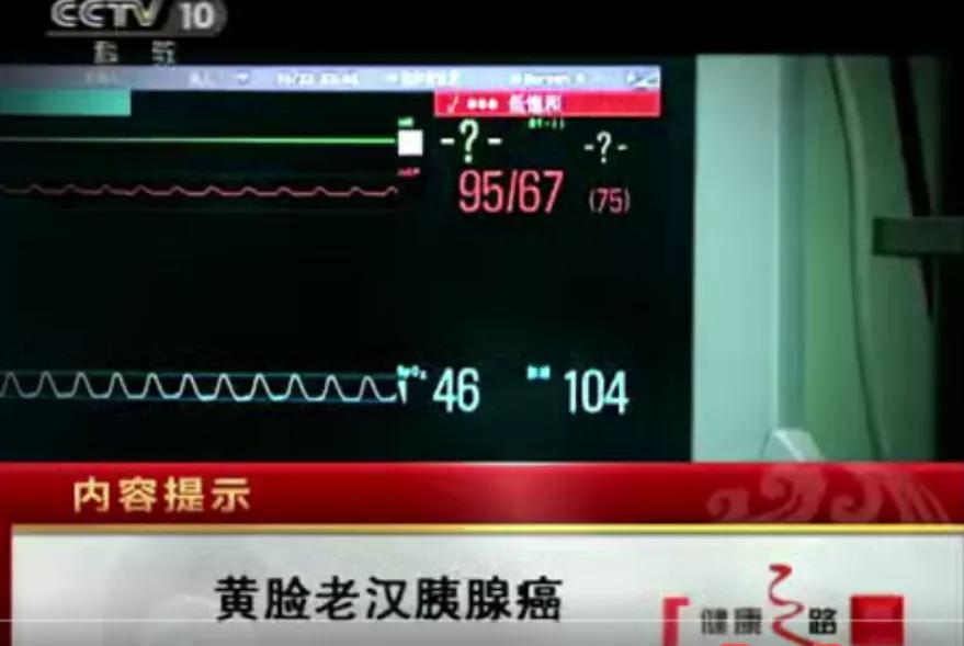 胰腺癌病人20年生存奇迹？让我们“一起寻找姜福生”