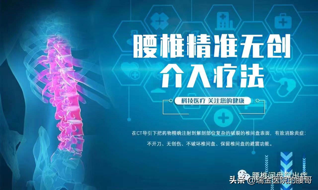 腰椎间盘突出麦肯基疗法康复视频,腰椎间盘突出卧床休息几周能康复