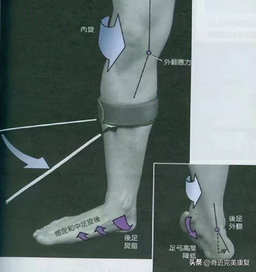 足底无力怎么改善,扁平足如何自我康复