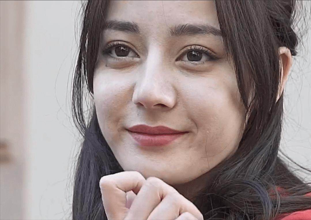 脸上有痘坑的明星,脸上爆痘特别多还好看的明星