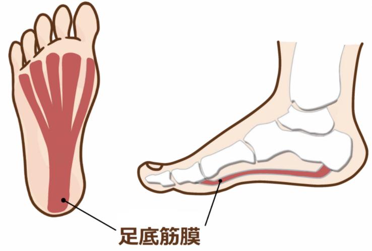 脚后跟疼的原因和治疗的方法,引起脚后跟疼痛的常见11种疾病