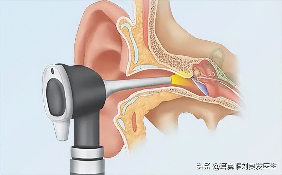 耳科知识科普针对老人图文,耳科知识科普