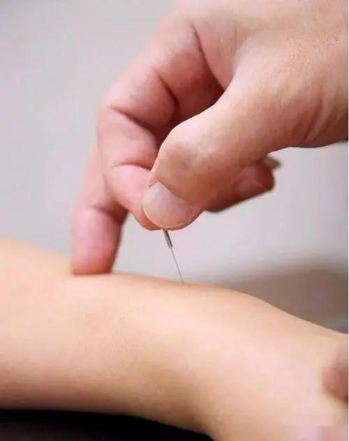 头部脑供血不足穴位,头部穴位针灸的作用