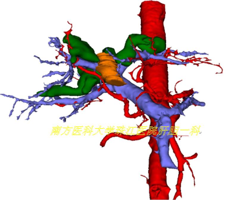 三维透视眼,透视眼治疗肿瘤