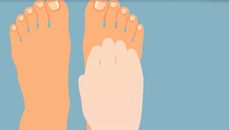 一走路脚趾甲疼,一走路脚趾疼是怎么回事