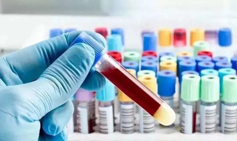 化疗期间如何做更好的康复训练,癌症患者化疗期间应该做什么