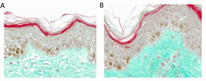 ccs积雪草油橄榄精华测评 (积雪草软膏能和橄榄油一起用)