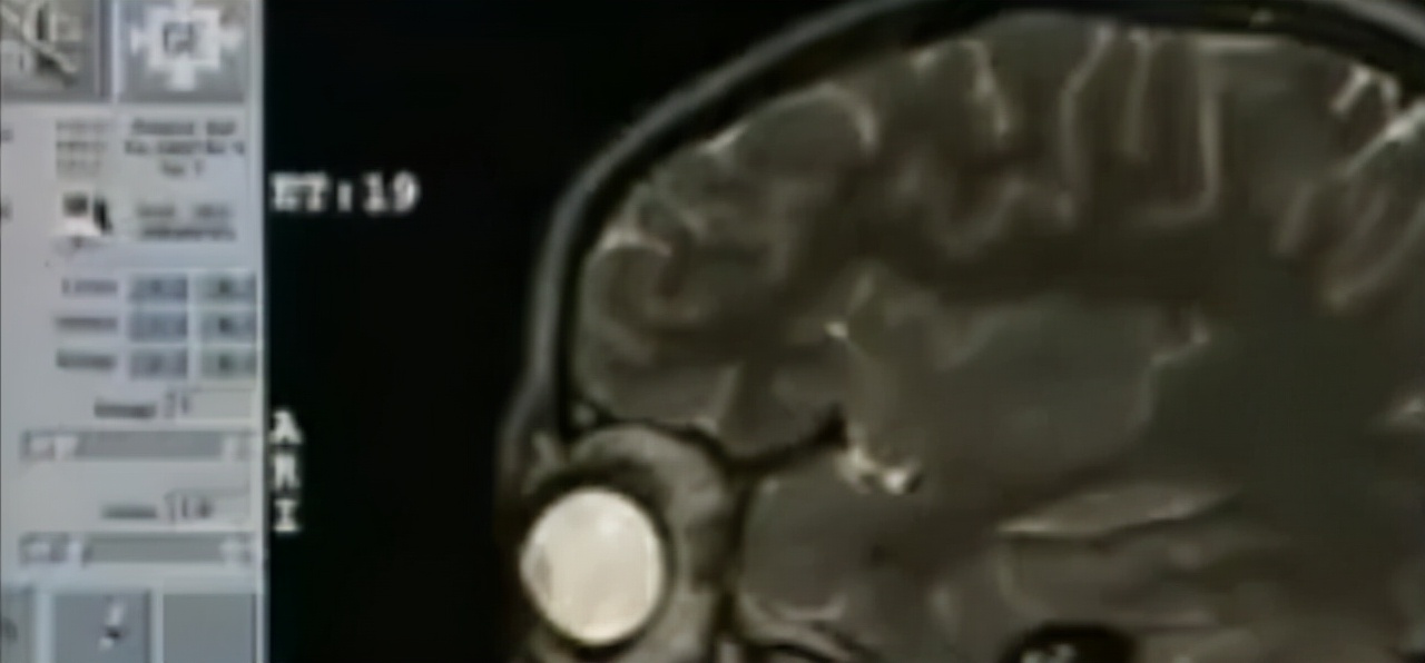 贵州女孩上课晕倒说自己家在福建,贵州女孩突然晕倒失忆下集