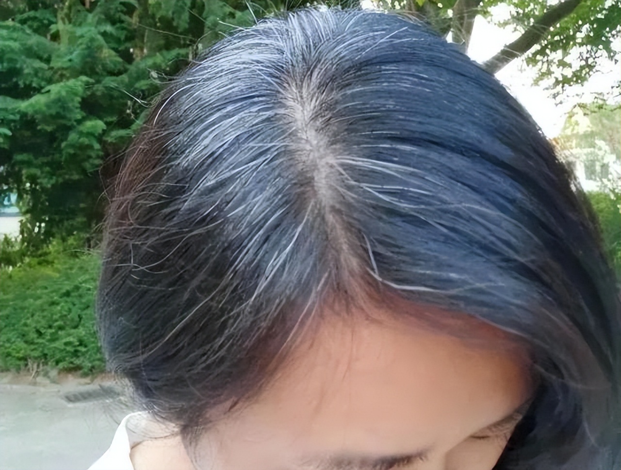 白头发的人不易得癌症是真的吗,为什么白头发不能拔迷信说法