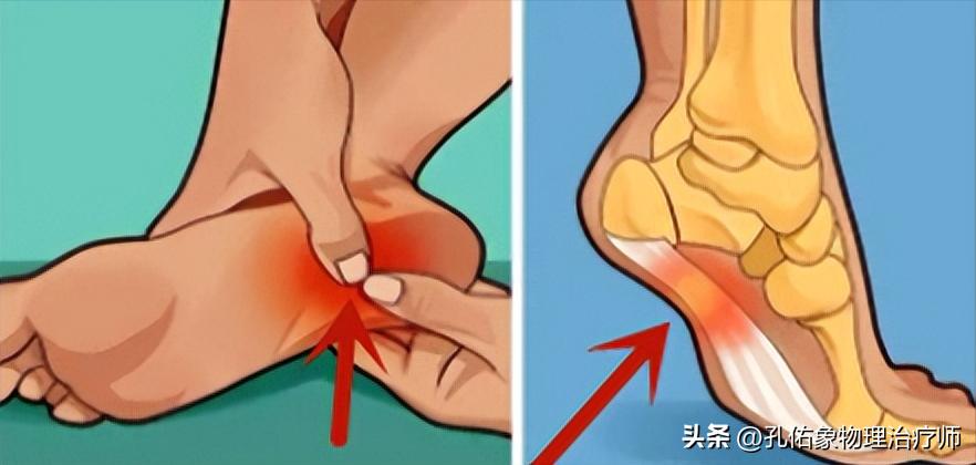 后背疼痛筋膜炎最好的恢复办法,后背肌筋膜炎全身不舒服