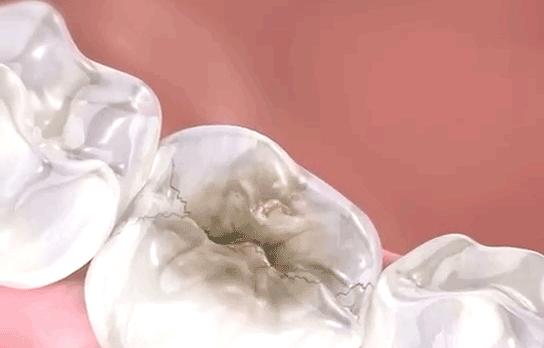 牙黄防口臭清除口腔异味的牙膏,专治牙黄口臭的牙膏正品云南白药