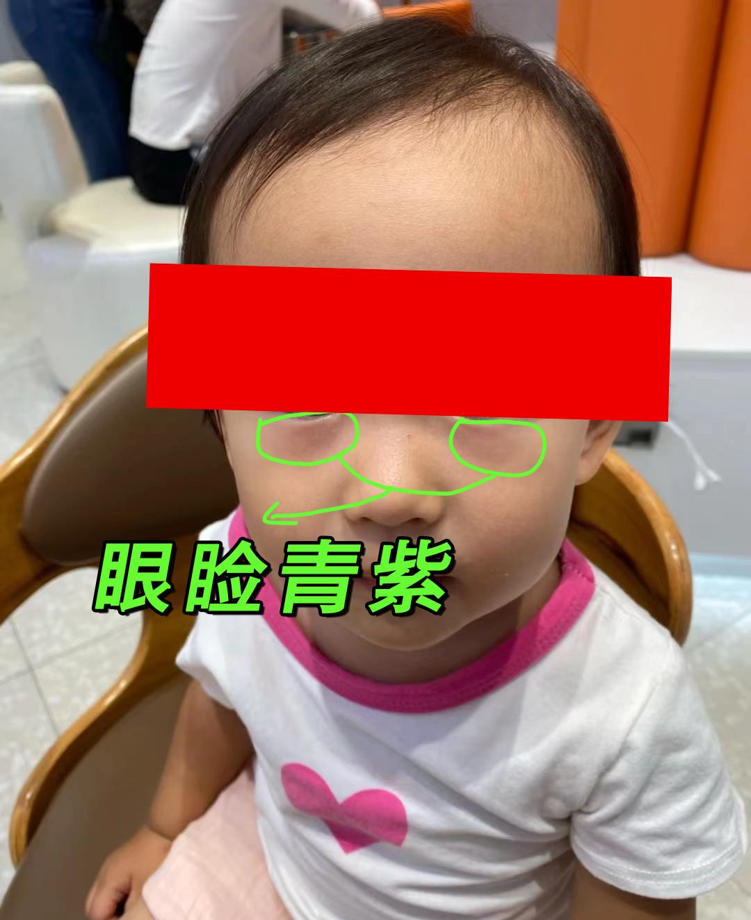 孩子身高瘦弱矮小该怎么办,孩子身高矮小什么原因