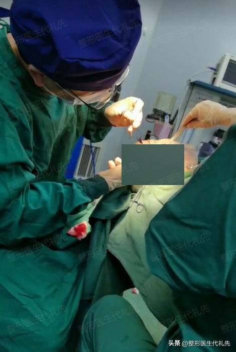 面部小切口提升悬吊术是小拉皮吗,面部提升拉皮分哪些部位