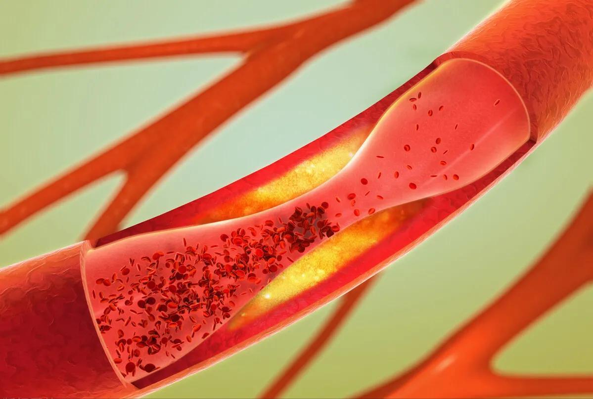 3味中药降血脂扩血管溶血栓,有哪些药可以降甘油三酯血脂