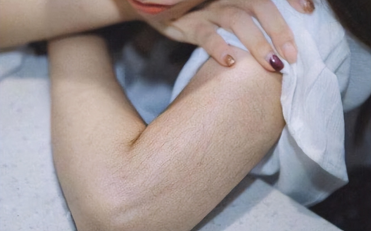 女性体毛生长旺盛与哪些原因有关,关于女性体毛过多的真实原因