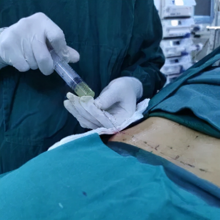 腰痛两年了一直治不好怎么办,反复腰疼怎么回事