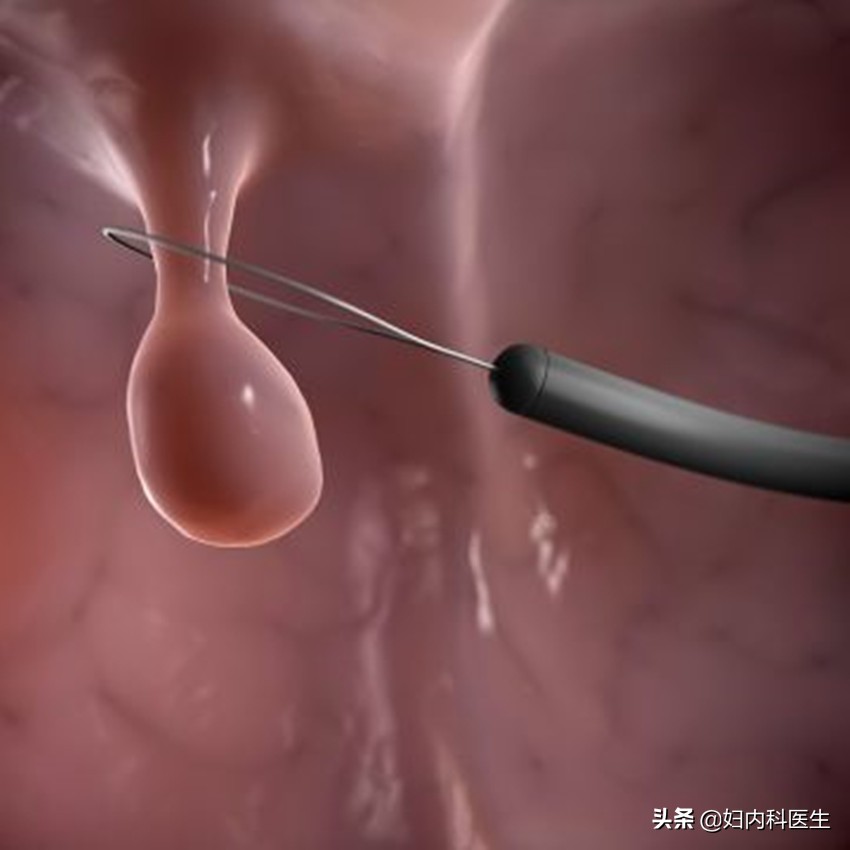 化验单结果和参考值怎样理解,检查单的结果怎么看