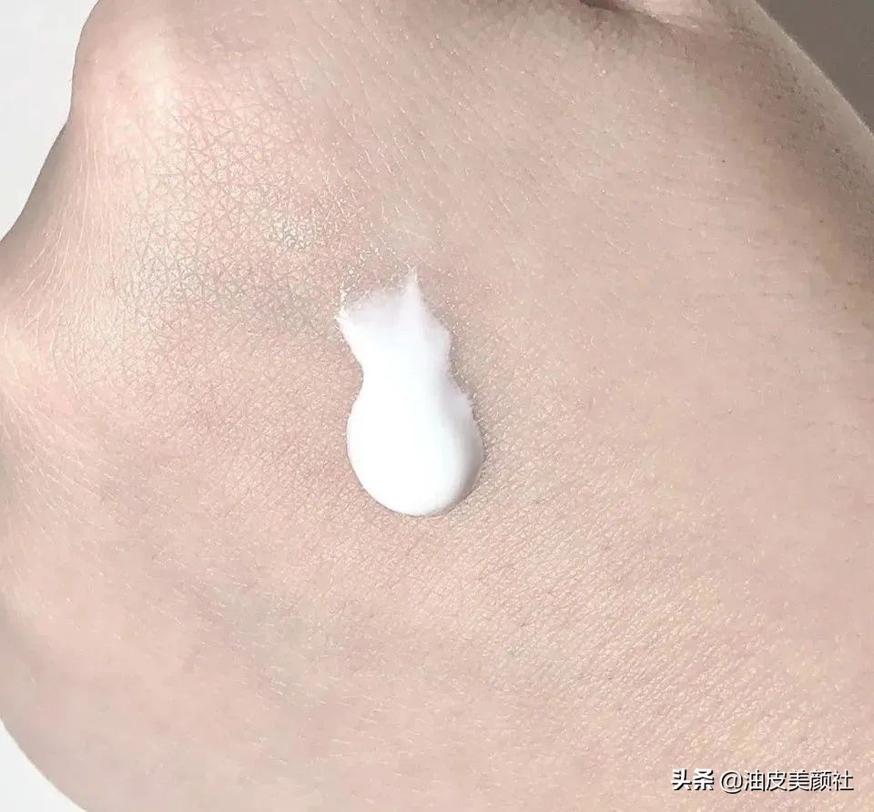 敏感肌泛红起痘怎么修复,红血丝痘印敏感肌怎么修复