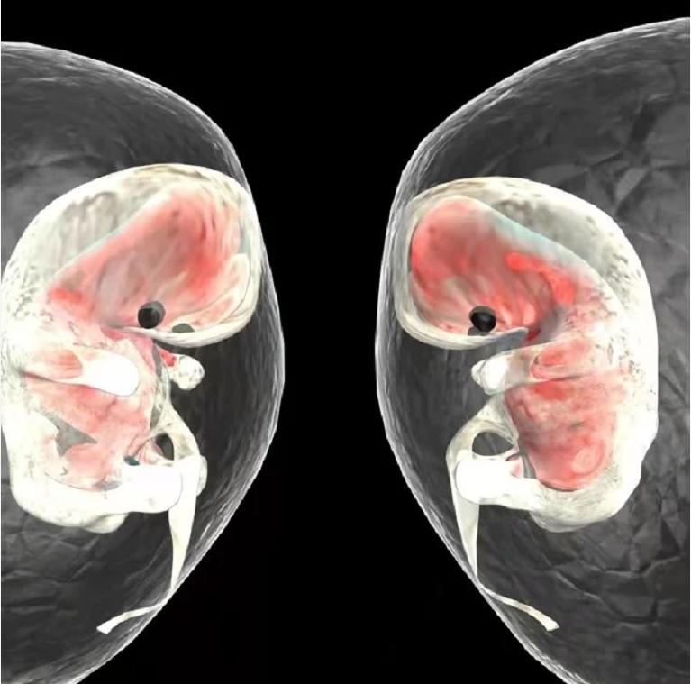 印度小伙意外怀孕,印度男子腹中神秘生物