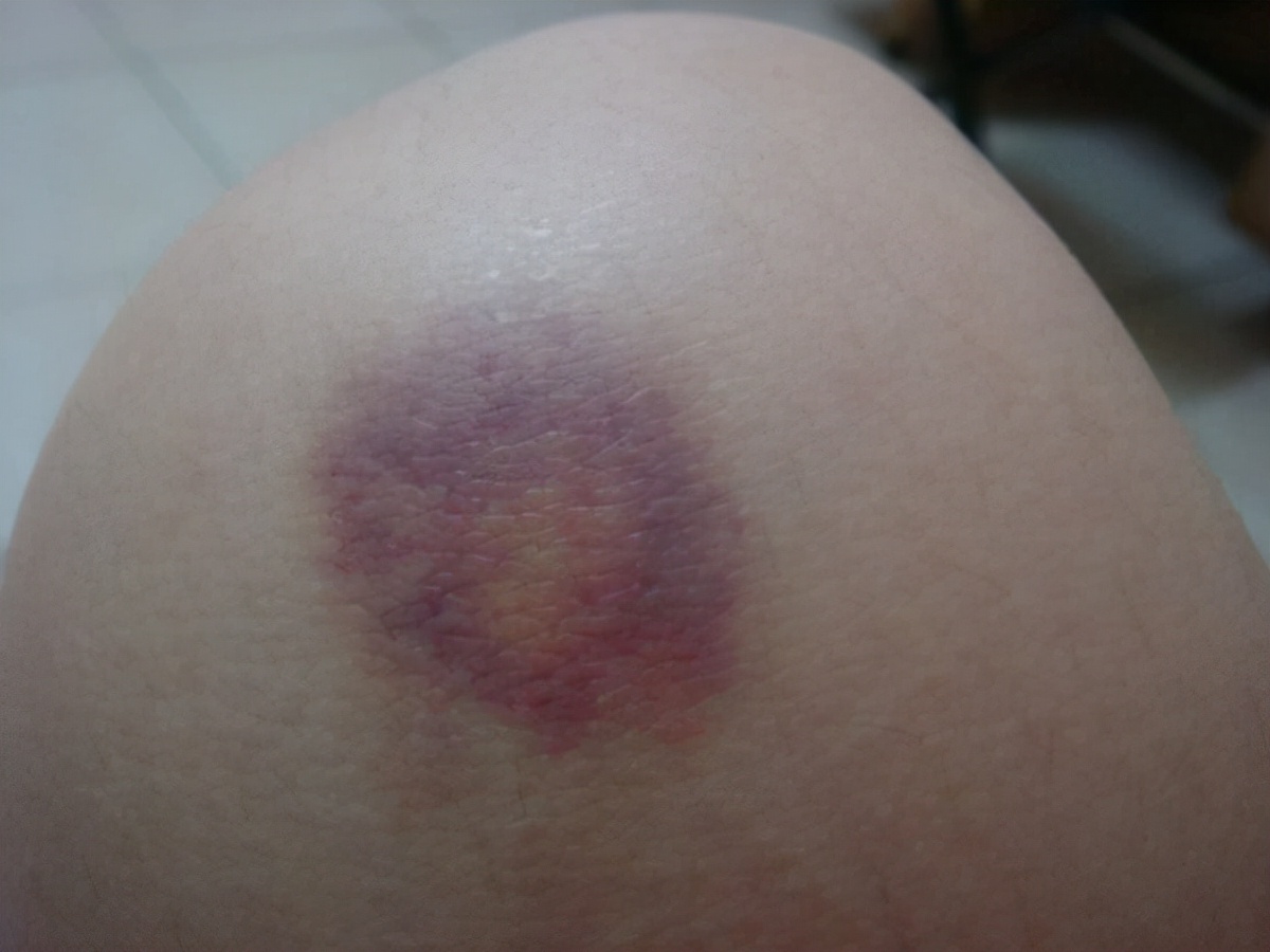 十个女人九个寒怎么化解,十个女人九个宫寒怎么办