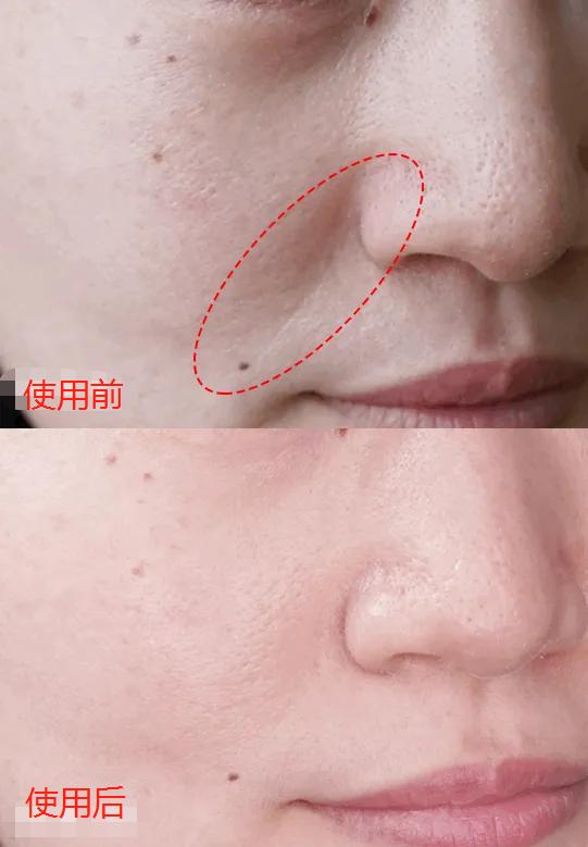 兰蔻菁纯眼精华秒杀,兰蔻菁纯臻颜玫瑰精萃水150ml价格