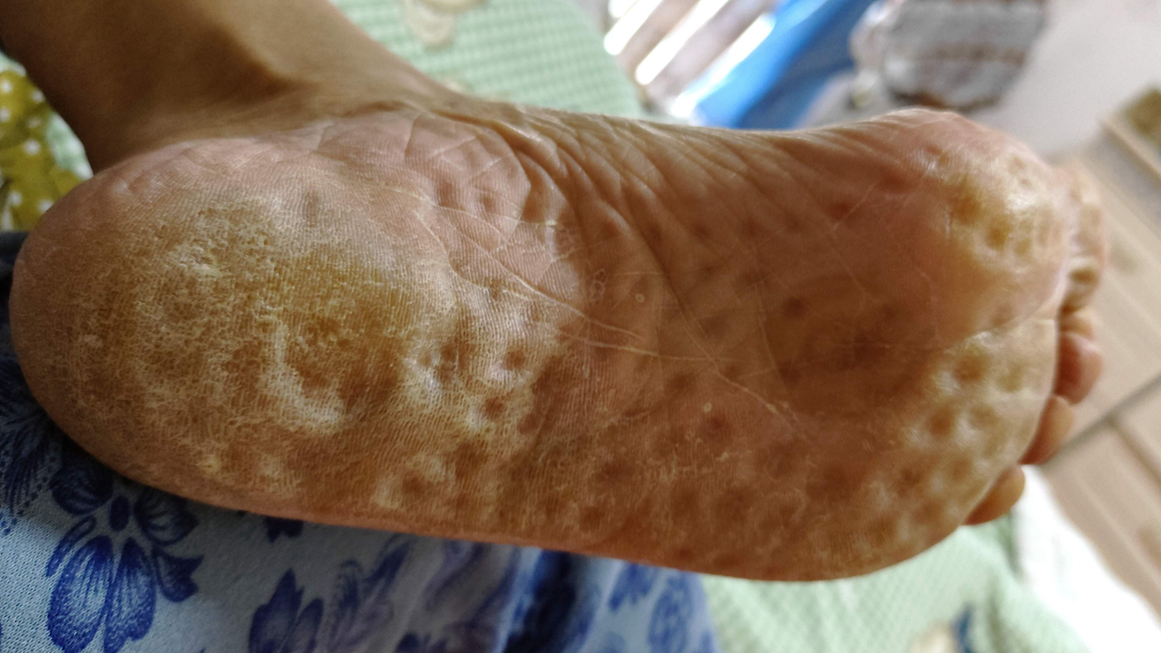 足疗按摩袜发明人老杨：揭秘古人智慧，实现的高效足疗按摩技术