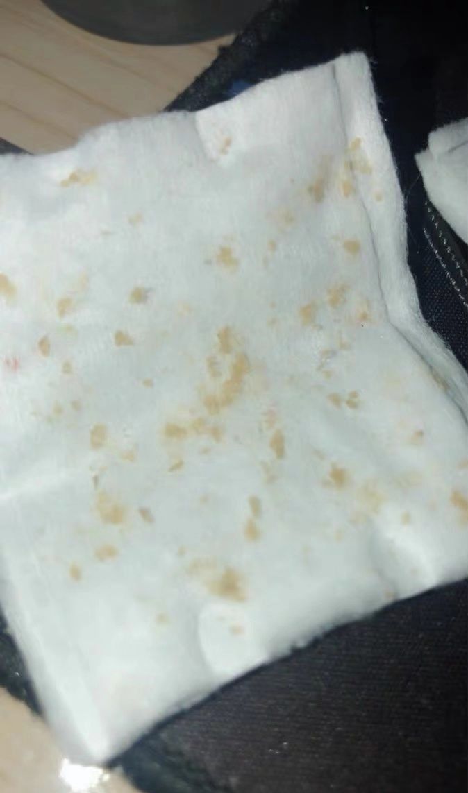 20年的黑头有多大,世界上最长的黑头到底有多长