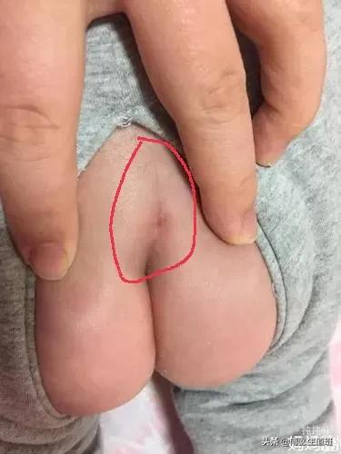 孩子6岁了老是尿床怎么办,男孩4岁尿床脊椎裂