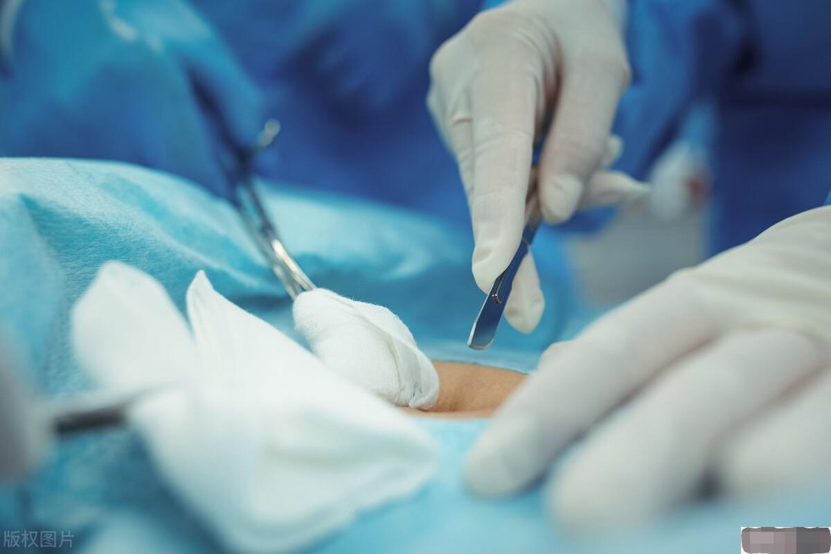 硫酸泼脸自救,硫酸泼到身上怎么自救