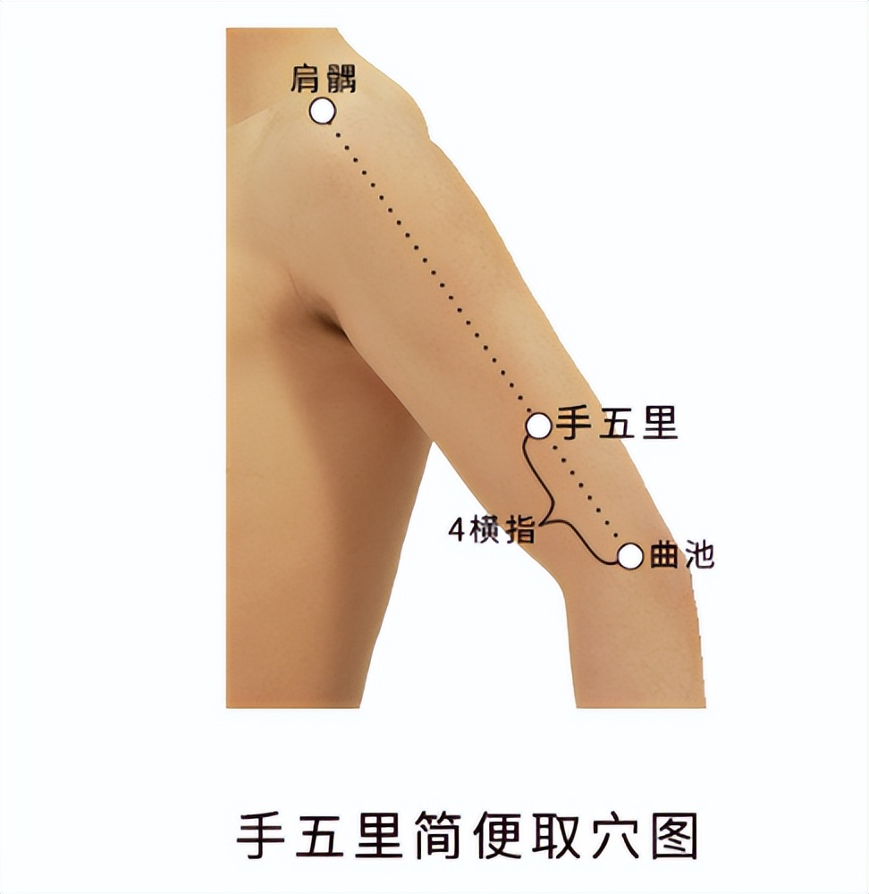 手五里——调理“肩周炎、偏瘫、落枕、嗜睡、颈淋巴结核”穴位