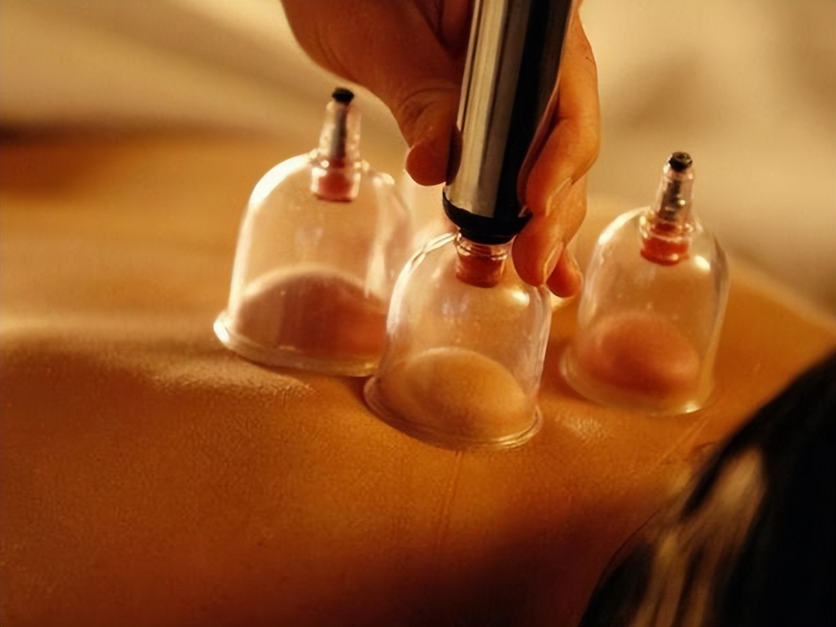 拔罐罐法,拔罐技术与方法