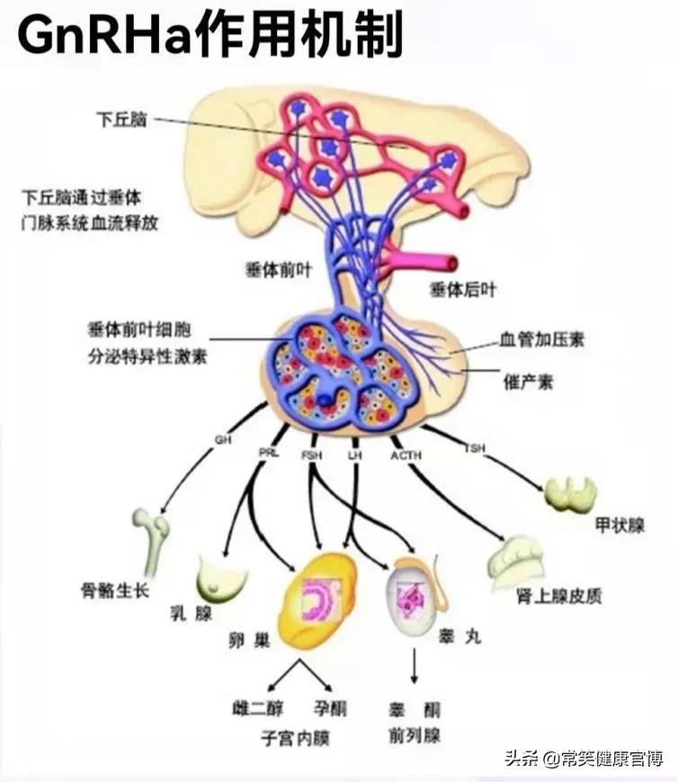 子宫内膜异位服药会有什么后遗症,子宫内膜异位症术后需要服药多久