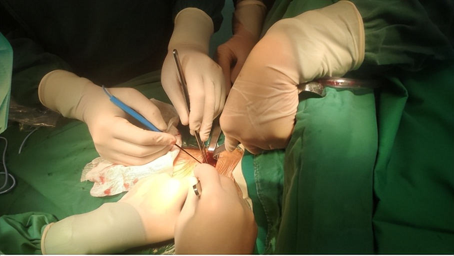 九八六医院手术室,九八六医院胸外科