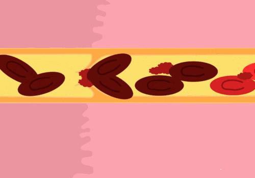 冬季养生如何补肾护阳润燥养阴,好的养生方法