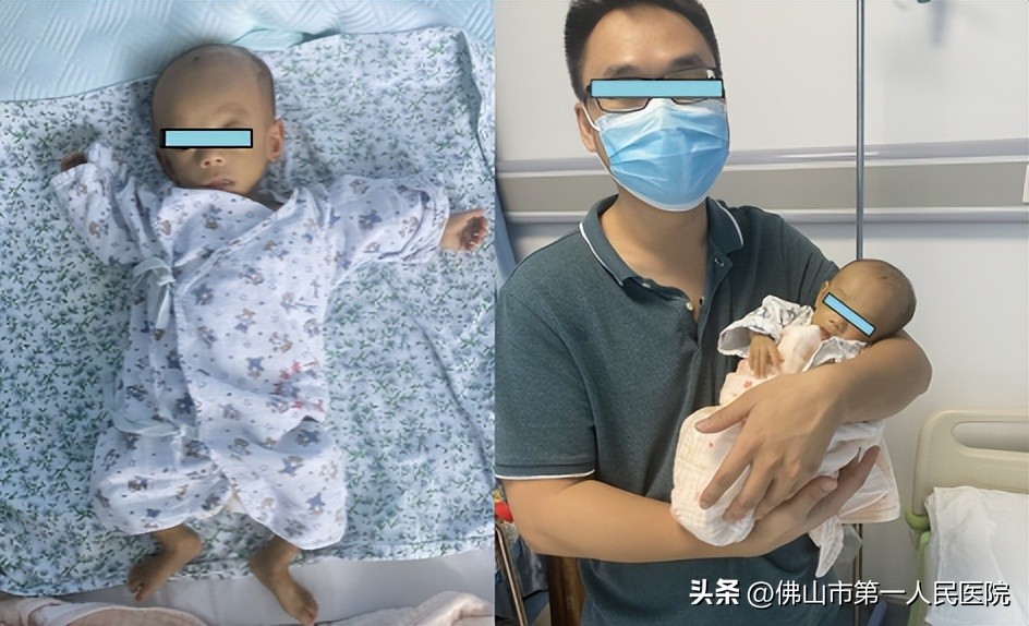 “袖珍宝宝”患短肠综合征，经不懈救治终获新生