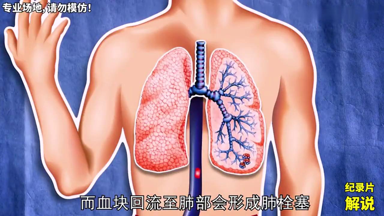 79-牛仔裤太紧能致死？#流言终结者