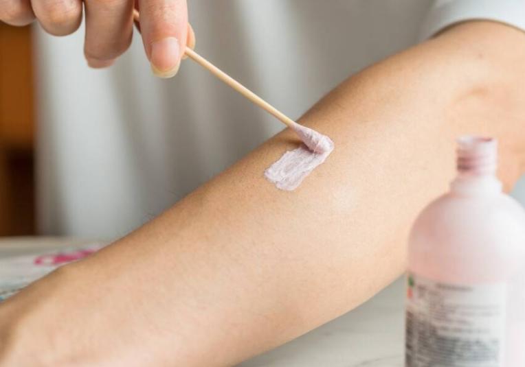 炉甘石洗剂功效多少钱一瓶,国字号炉甘石洗剂的功效与作用