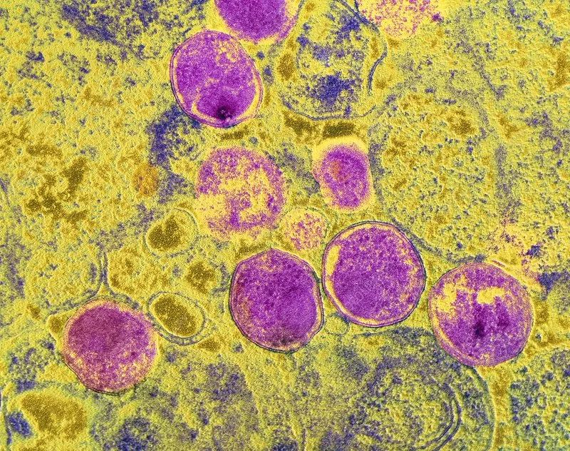 肠道菌群由哪些细菌组成,深度分析肠道细菌