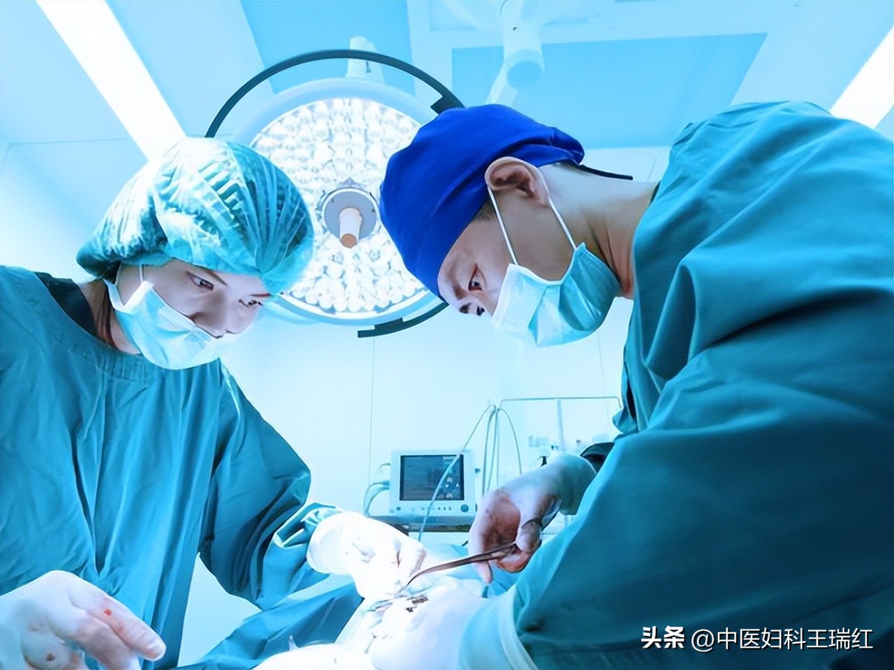 盆腔积液巧克力囊肿,巧克力囊肿盆腔会痛吗