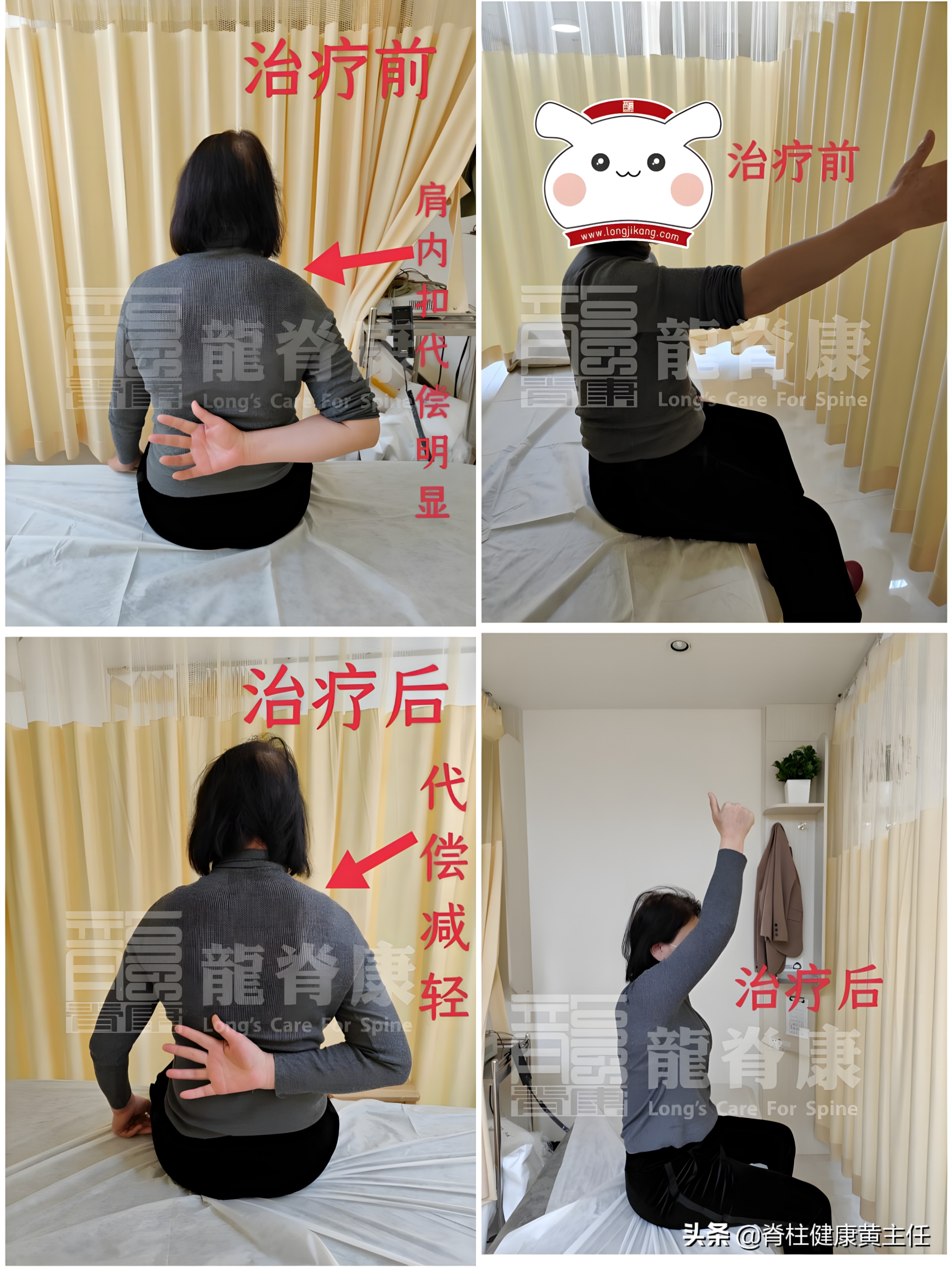 肩膀活动疼痛但活动不受限,肩膀活动受限疼痛挂什么科